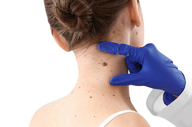 Bulk Wart Removal Ointments that Deliver Unbeatable Results